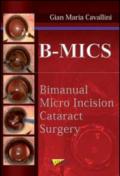 B-MICS Bimanual micro incision cataract surgery