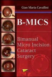 B-MICS Bimanual micro incision cataract surgery