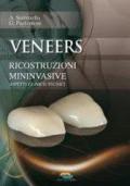 Veneers. Ricostruzioni mini-invasive
