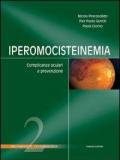 Iperomocisteinemia. Complicanze oculari e prevenzione