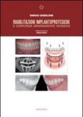 Riabilitazioni implantoprotesiche e chirurgia minimamente invasiva