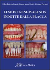 Lesioni gengivali non indotte dalla placca