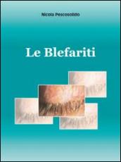 Le blefariti