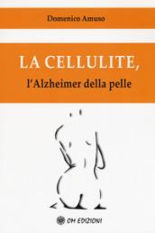 La cellulite. L'alzheimer della pelle