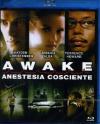 Awake - Anestesia Cosciente