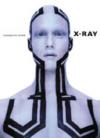 X-ray