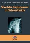 Shoulder replacement in osteoarthritis